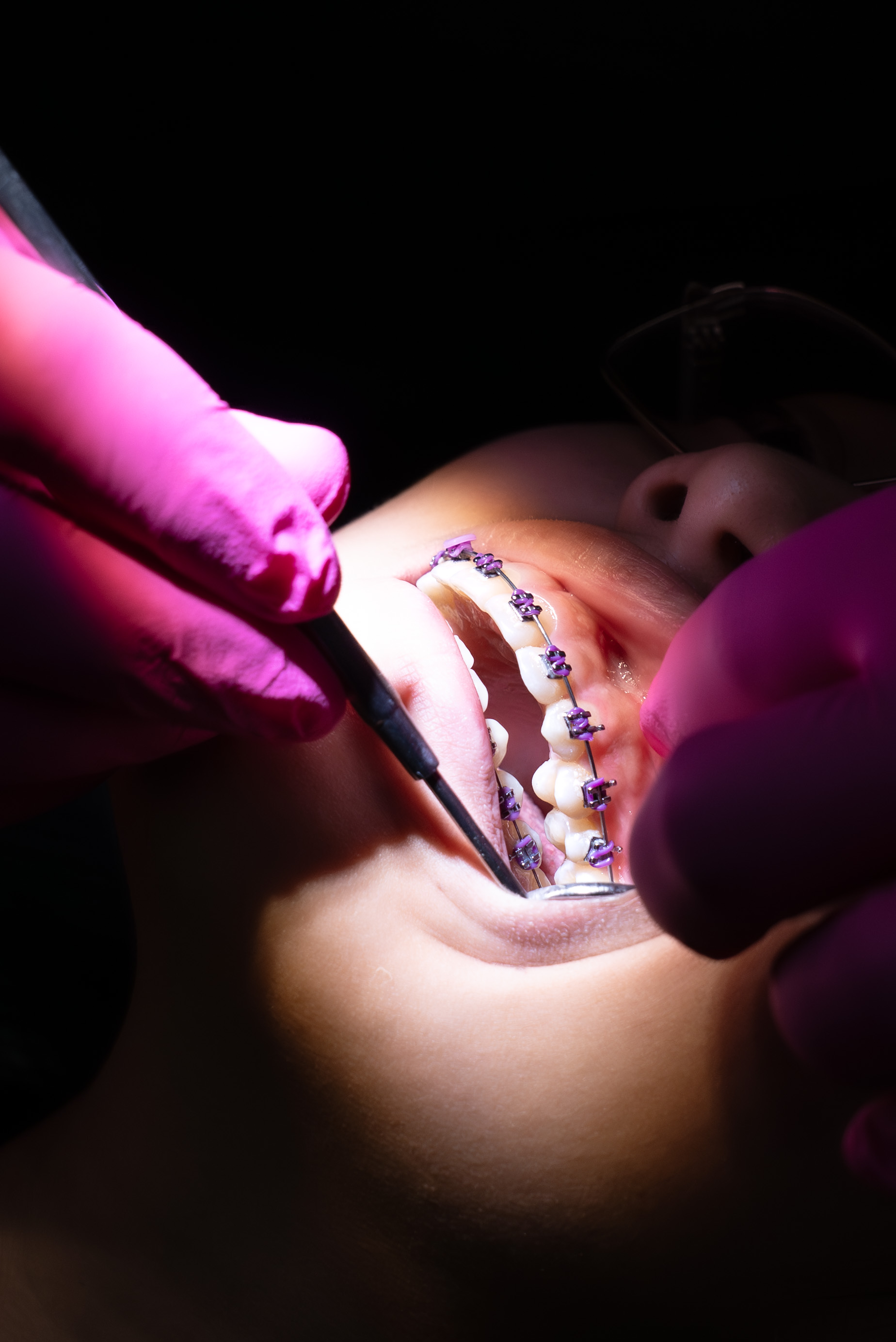 Advanced Orthodontics